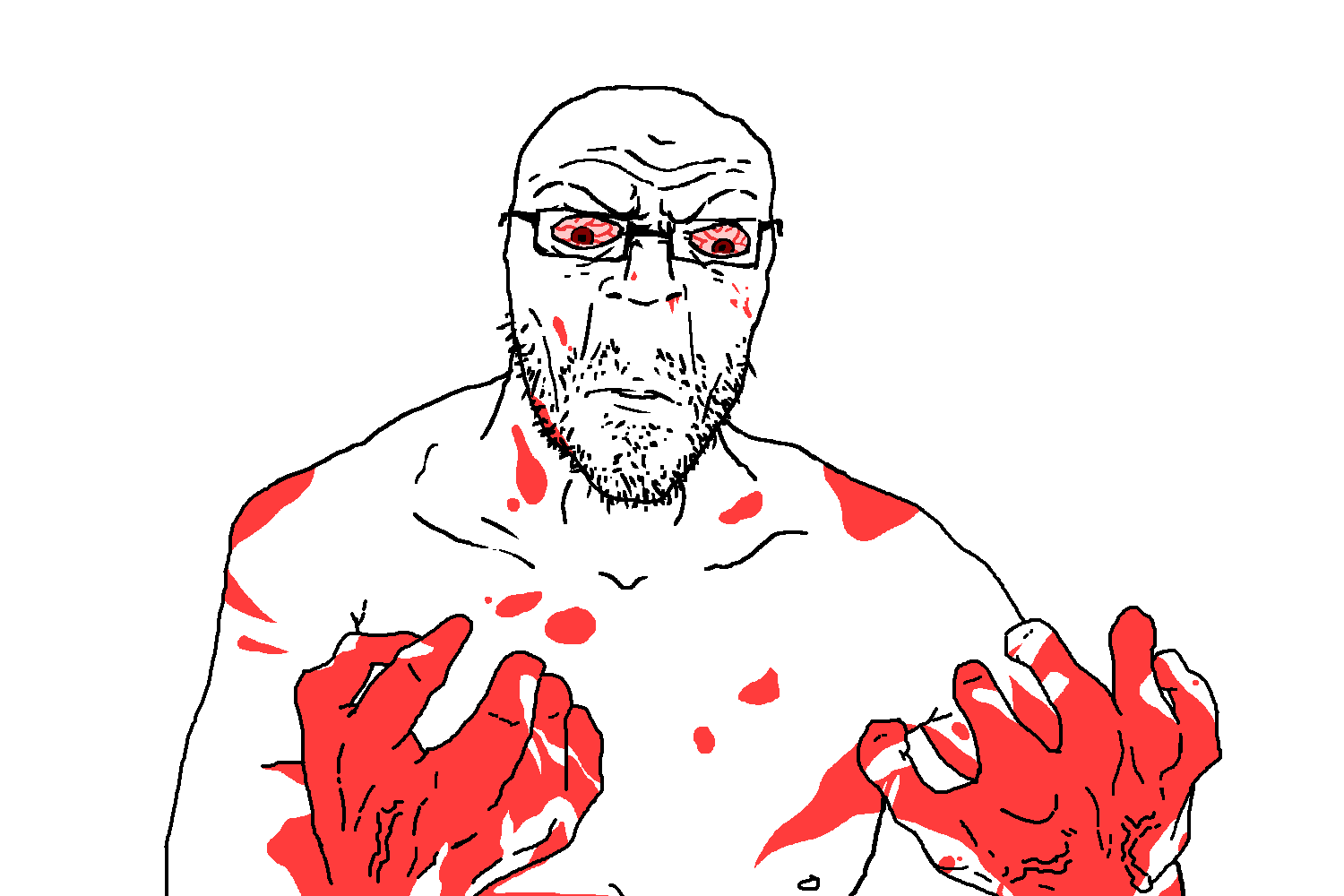 dumjacque, angry, bald, blood, blood from nose, blood on face, blood on hand, bloodshot eyes, closed mouth, crazed