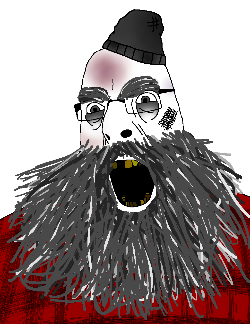 cobson, 1soyjak, beanie, beard, big beard, broken teeth, bruise, bruised, clothes, eyebags