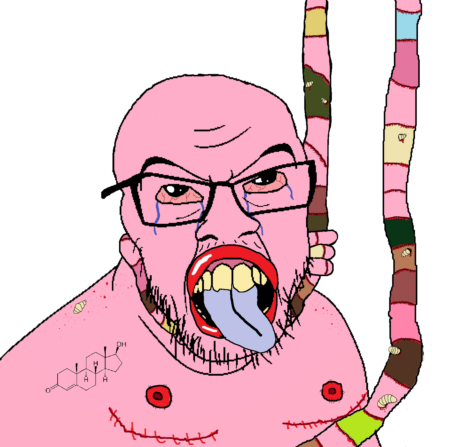 feraljak, acne, anhero, bloodshot eyes, crying, frankenpenis, ftm, glasses, hanging, looking up