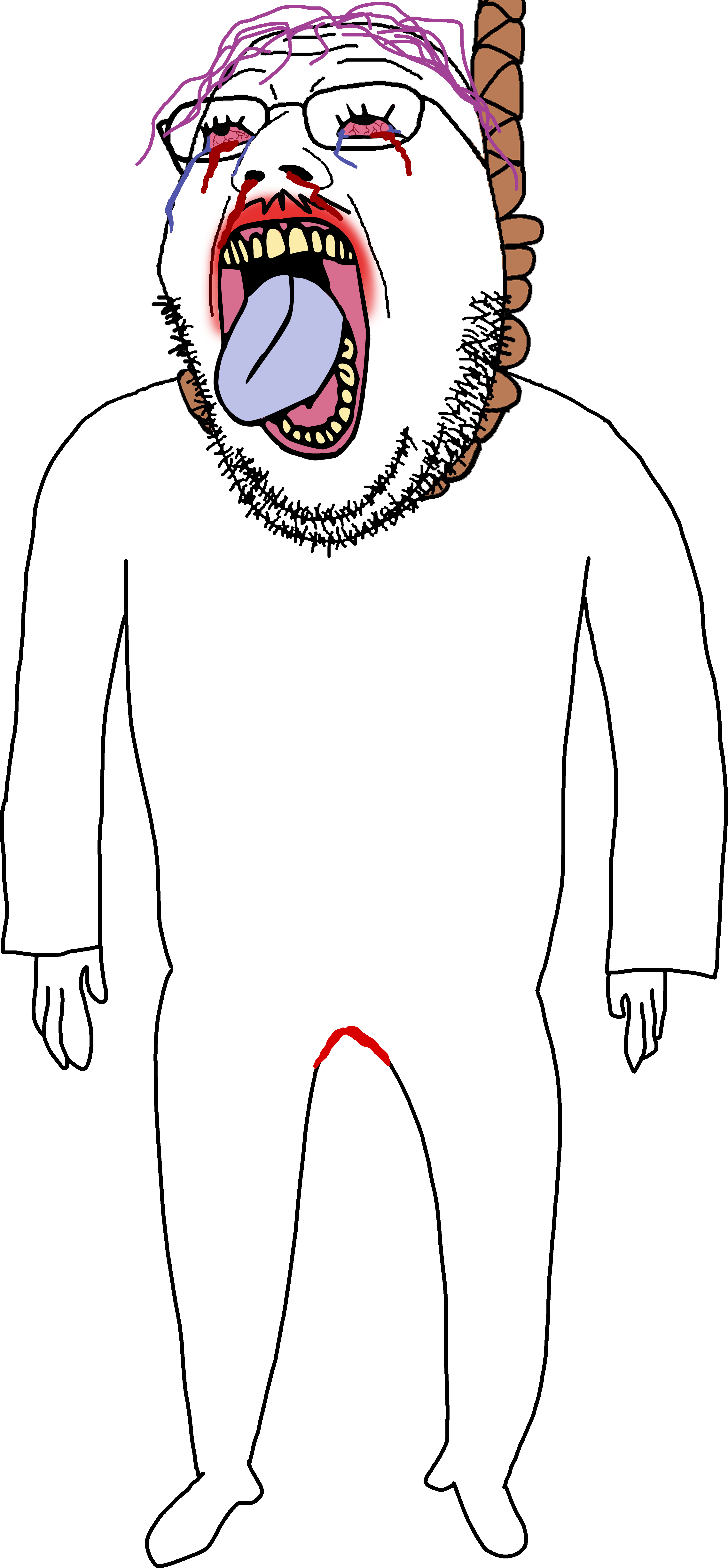 bernd, gapejak, nutroonella, retraced gapejak, ack, bleeding, bleeding eyes, bleeding wound, blood on face, bloodshot eyes