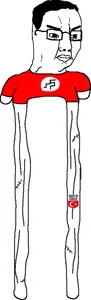 leg lengthening surgery chud.png