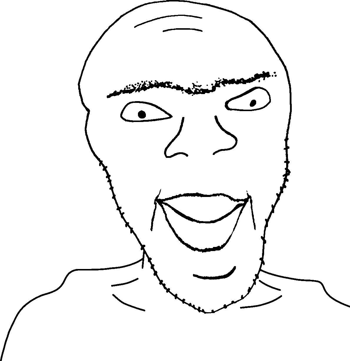 feraljak, fernbert, deformed feraljak subvariants, bald, big lips, closed mouth, cross eyed, deformed, lips, no glasses
