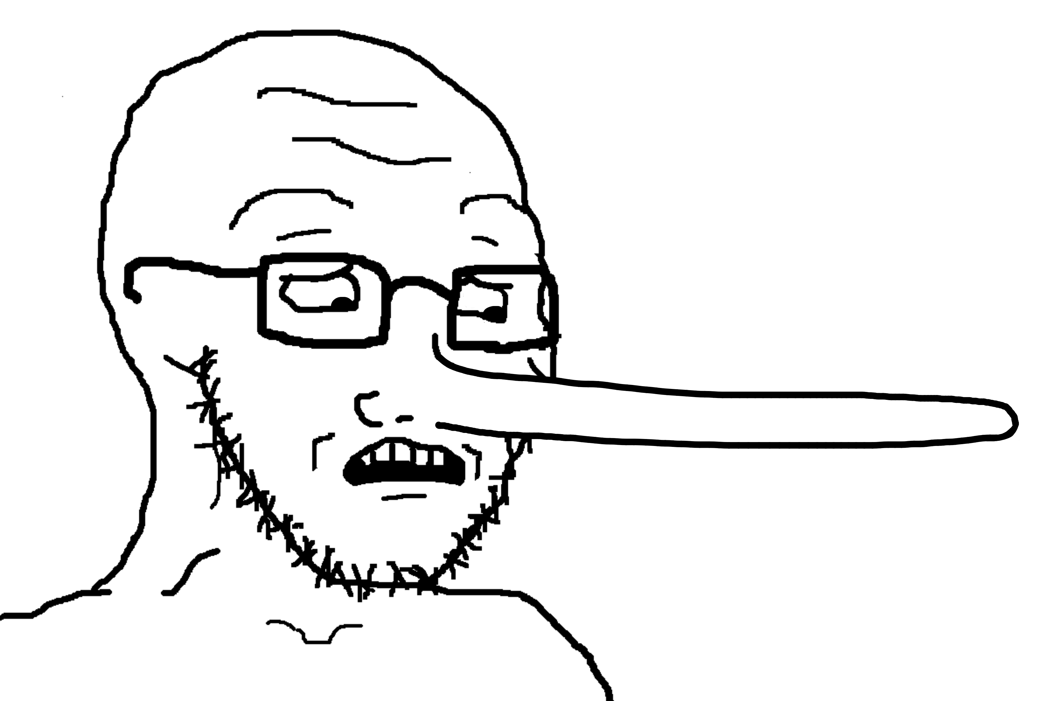 soyak, soyak (concerned), 1soyjak, bald, concerned, eyebrows, glasses, half open mouth, jewish nose, lie