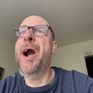 unknown, bald, glasses, open mouth, stubble, white skin