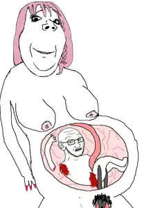 abortion.png
