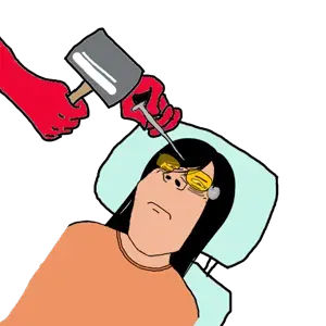 cobble lobotomy.png