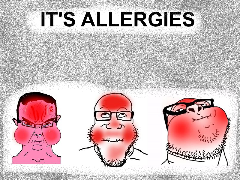 childut, chudjak, markiplier soyjak, chudjak front, its over, 3soyjaks, allergic reaction, allergy, angry, bald