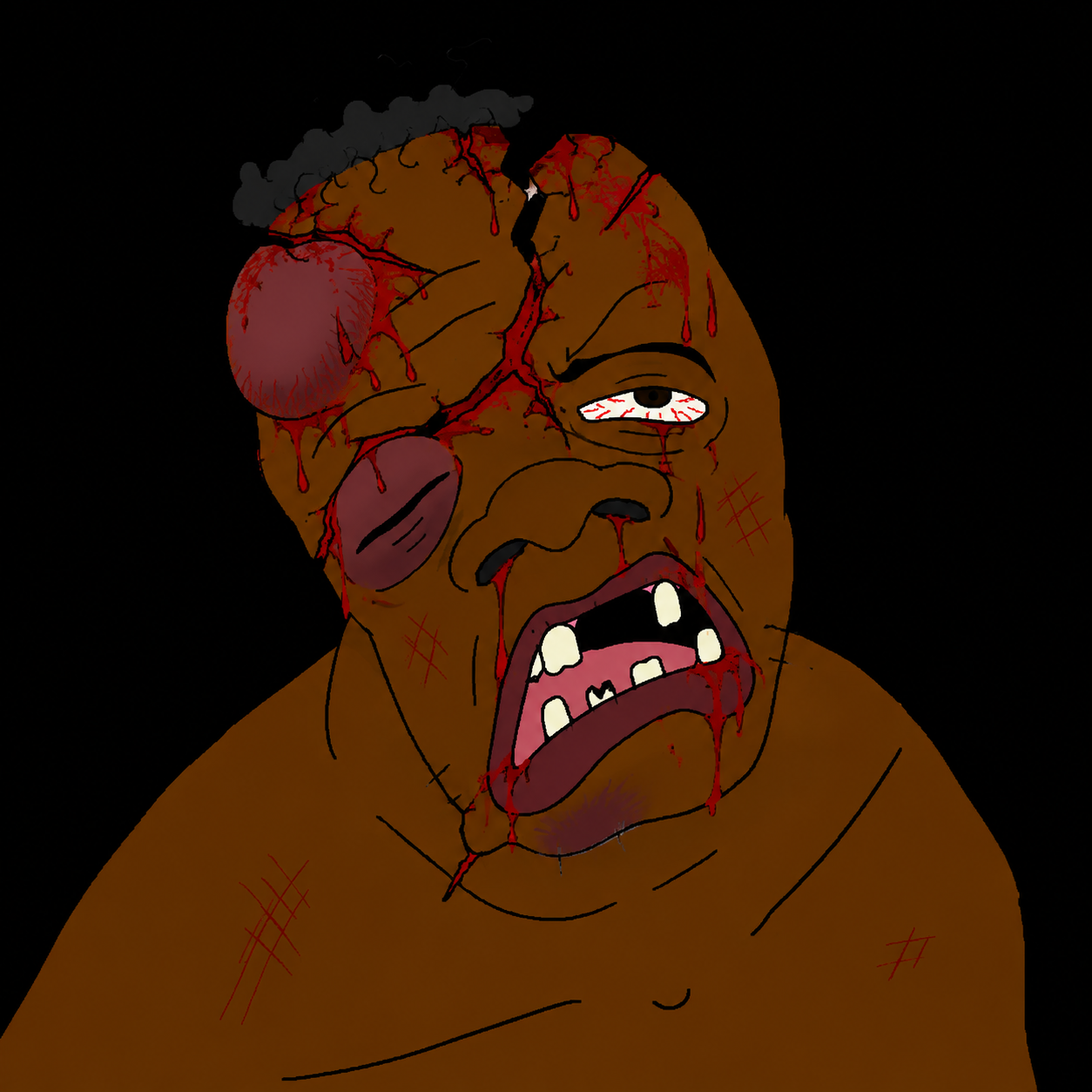 feraljak, feralnigger, big lips, black background, black eye, black hair, black skin, blood, bloodshot eyes, bruise