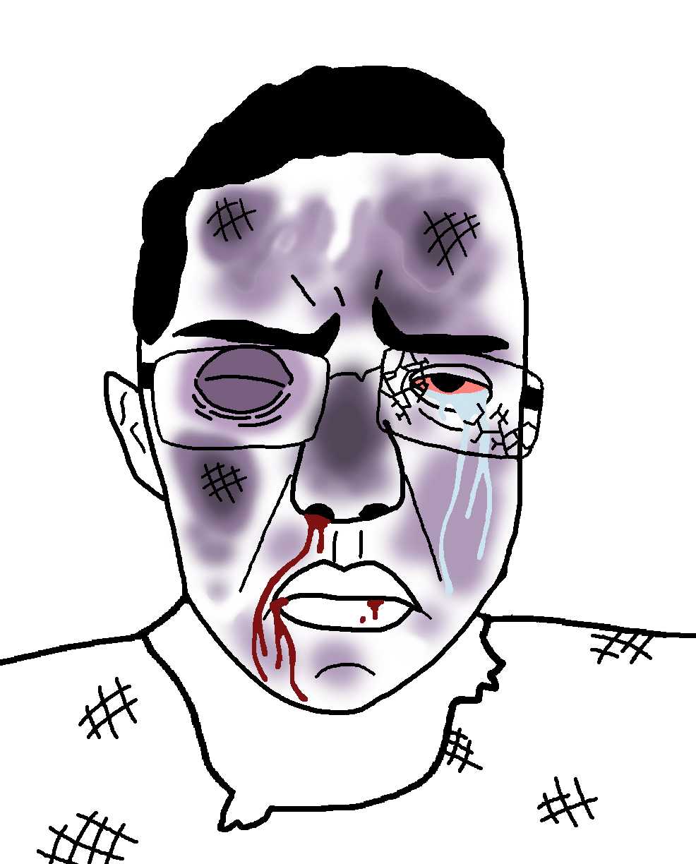 chudjak, patrick, sadtrick, 1soyjak, beaten, big lips, black eye, black hair, blood, blood from nose