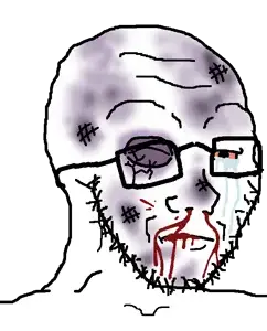 'oyak_hurt.png