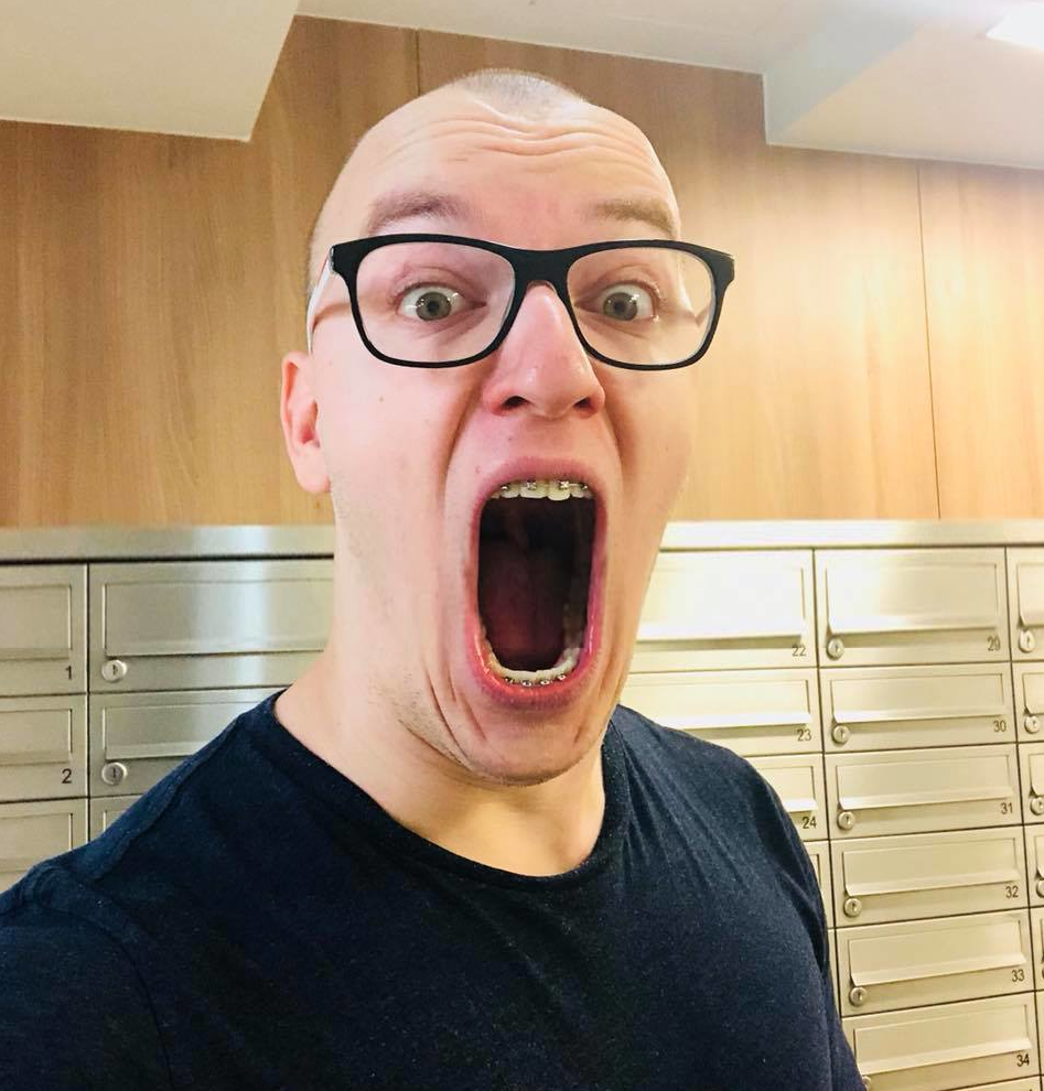 gimper, 1soyjak, bald, black shirt, braces, clothes, ear, front view, gaping mouth, glasses
