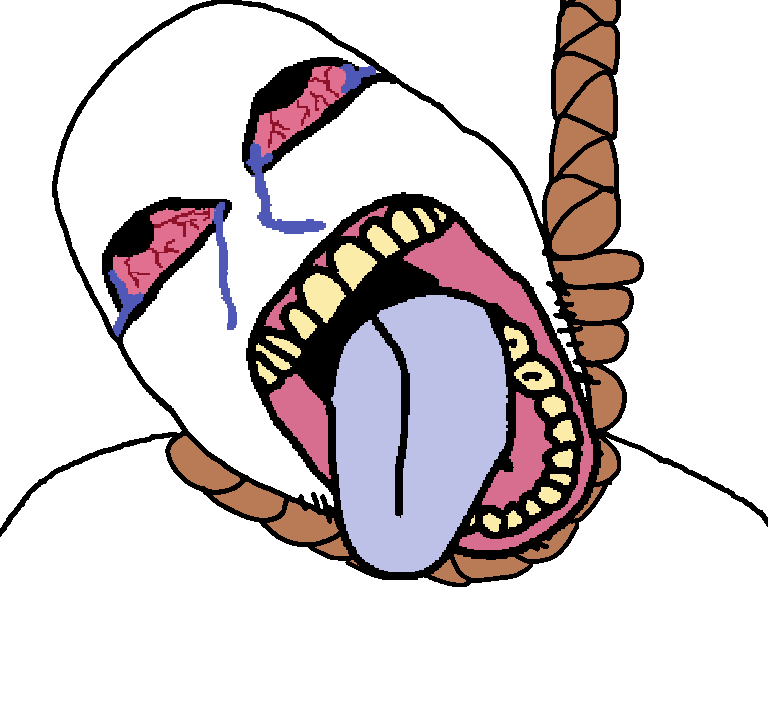 bernd, hanging troonjak, troonjak, tismjak, 1soyjak, ack, autism, bald, big eyes, big mouth