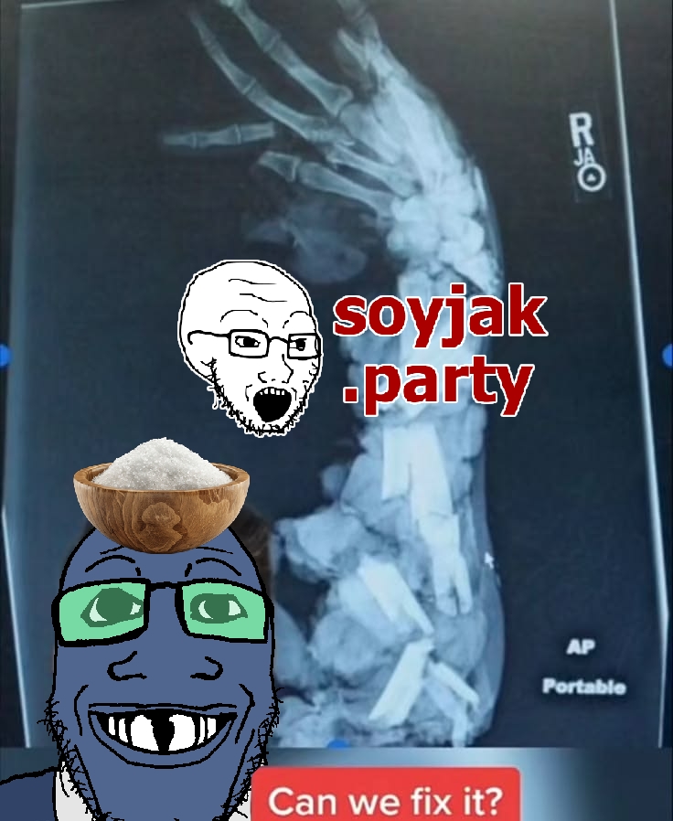 markiplier soyjak, soyak, grinlook poggers, 2soyjaks, bald, black eyes, blue skin, broken bones, chubby, glasses