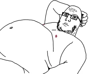 nikocado avocado, cadojak body, bald, black eyes, closed mouth, eyebrows, fat, forehead lines, glasses, half body