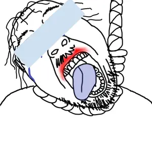 bernd, hanging troonjak, troonjak, hanging namefags, 1soyjak, ack, bald, blue tongue, crying, eyebrows