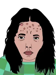 chudjak, goldberg, patrick, femjak, 1soyjak, acne, black eyes, black hair, closed mouth, female