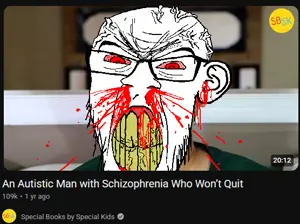 feraljak, feralrage, 1soyjak, angry, autism, autistic, bald, blood, blood from nose, blood spray