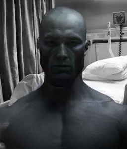 gigachad, bald, bed, blanket, buff, cancer, closed mouth, front view, hospital, hospital bed