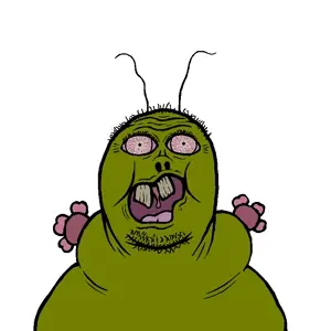 namefageverybaldilikes, antenna, antennae, bald, balding, black eyes, black hair, bloodshot eyes, fat, forehead lines