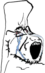 soyak, soyak (crying), 1soyjak, bald, crying, deformed, disgusted, distorted, glasses, looking to the right