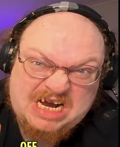 calvin, irl soyjaks, 1soyjak, angry, balding, beard, blue eyes, brown hair, cracked teeth, crooked teeth