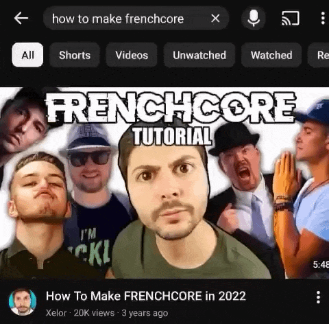 frenchjak, irl soyjaks, 1soyjak, big eyes, brown hair, closed mouth, clothed, clothes, french, frenchcore