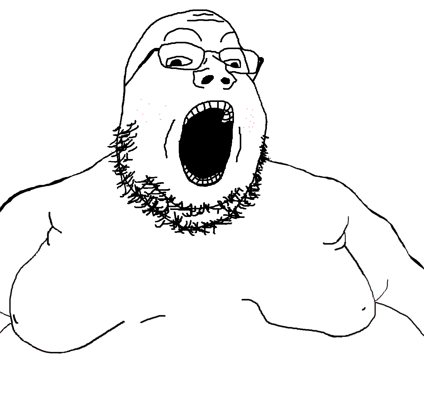 gapejak, obese gapejak, 1soyjak, acne, bald, black eyes, chubby, fat, forehead lines, gaping mouth