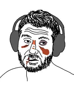 unknown, 1soyjak, beard, beaten, black eyes, black hair, blood, blood from mouth, blood on face, bruise