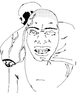 https://en.wikipedia.org/wiki/Rear_naked_choke the original image is even funnier than this for a few reasons