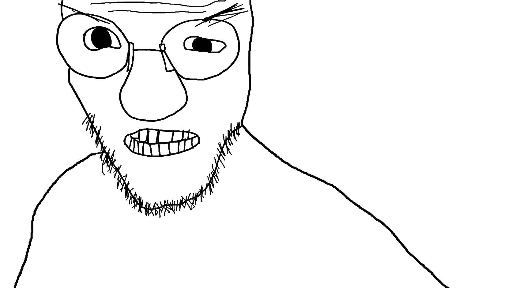 unknown, zorblenork, 1soyjak, angry, bald, big nose, black eyes, eyebrows, forehead lines, front view