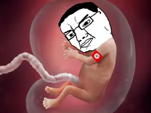 chudjak, armband, baby, clothes, fetus, glasses, hair, nazism, soyjak, swastika
