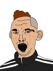 kuzjak, acne, bad teeth, bloodshot eyes, brown hair, clothes, drool, ear, hair, lesboseq