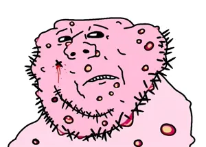 impish soyak ears, acne, blood, frown, gross, pink skin, soyjak, stubble, teeth, ugly