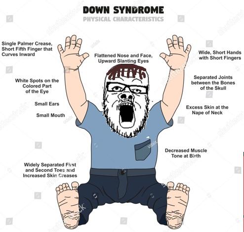 a24 slowburn soyjak, arm, brown hair, clothes, downs syndrome, feet, full body, glasses, hair, hands