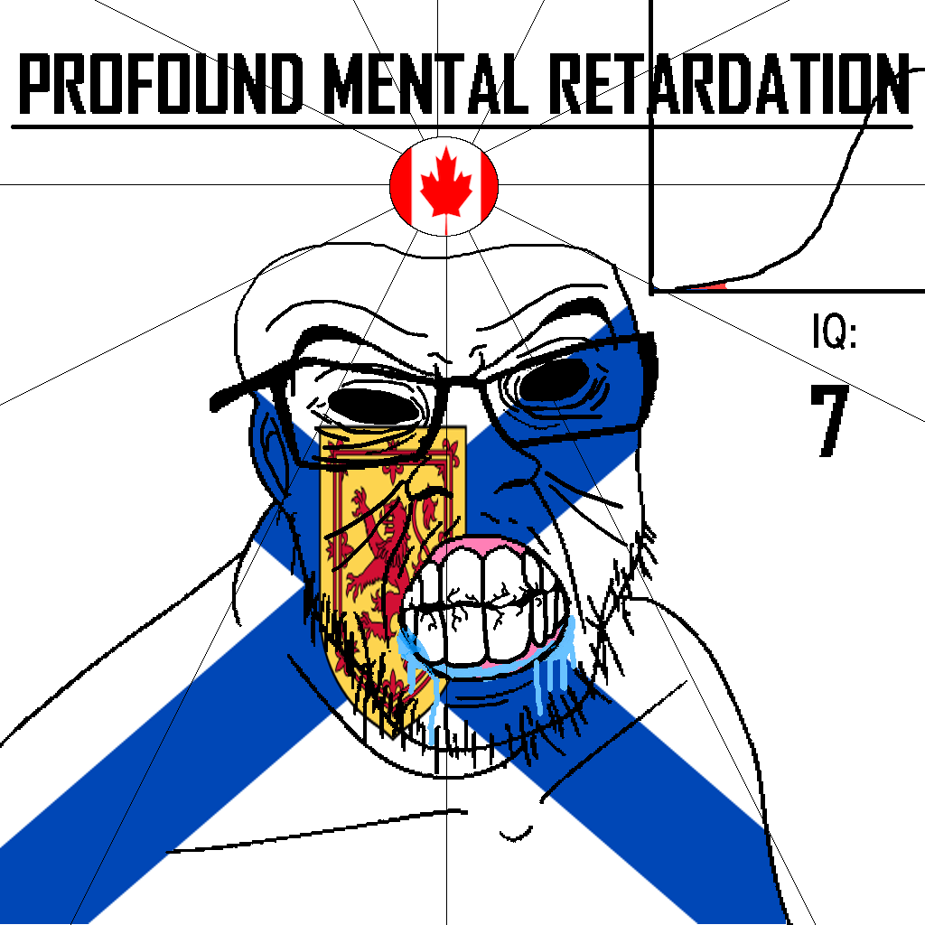 feraljak, angry, bald, black eyes, black hole, black sclera, canada, clenched teeth, closed mouth, country