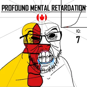 feraljak, angry, bald, black eyes, black hole, black sclera, canada, clenched teeth, closed mouth, country
