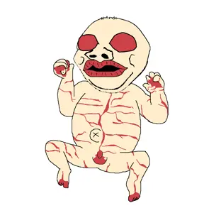 gapejak, nathaniel, baby, deformed, hair, harlequin ichthyosis, red eyes, red skin, soyjak, white skin