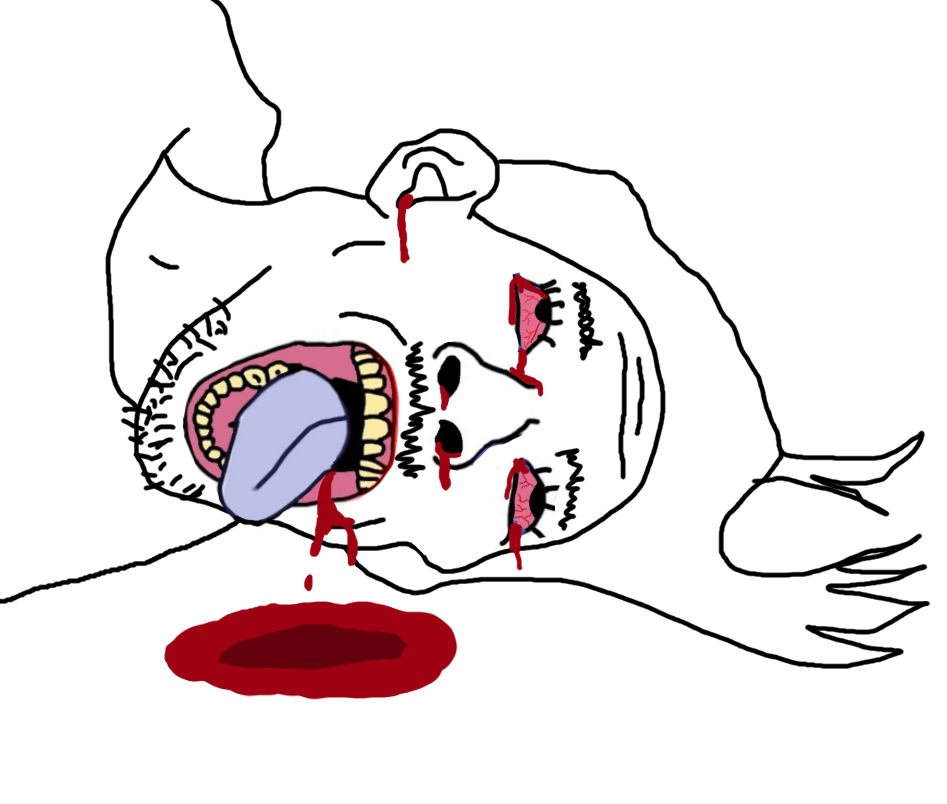 donald trump, bernd, 4cuck, ack, assassination, blood, bloodshot eyes, dead, hanging, op is a retarded lazy faggot for not tagging his own shit